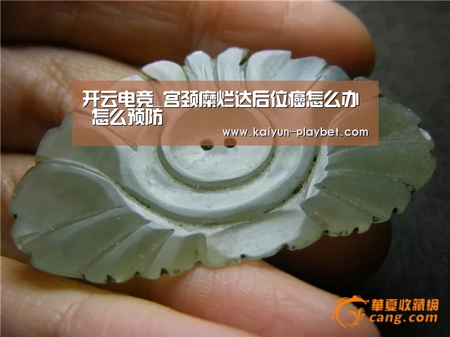 开云电竞_宫颈糜烂达后位癌怎么办 怎么预防(图2) 开云首页