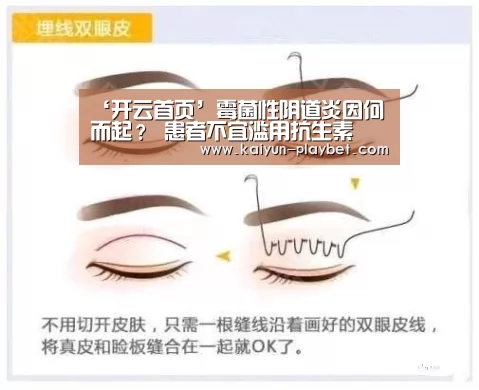 ‘开云首页’霉菌性阴道炎因何而起? 患者不宜滥用抗生素(图1) 开云首页